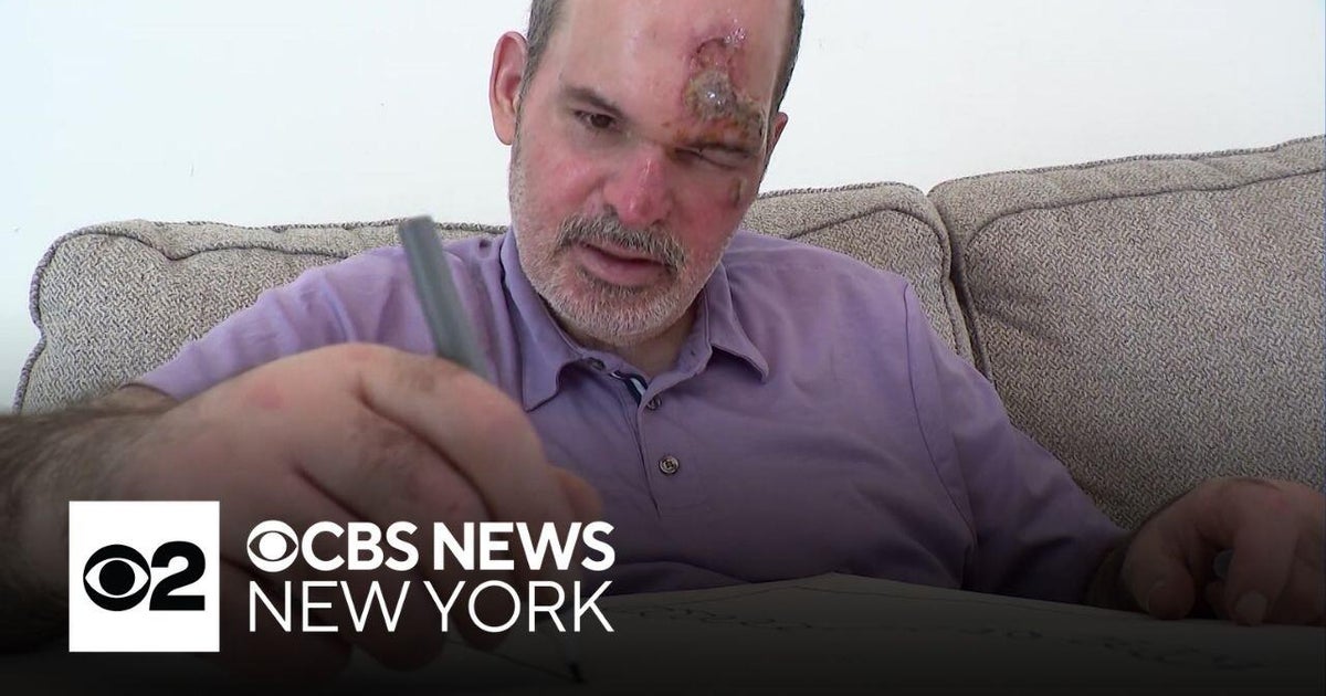 Person at NYC Marathon spots missing man from Long Island - CBS New York