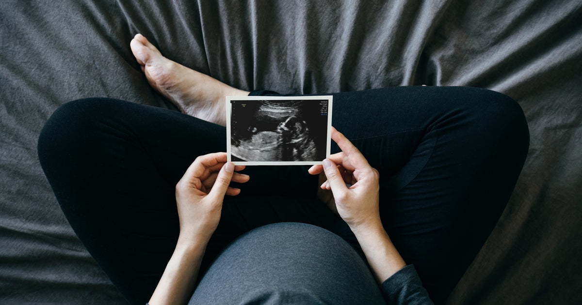 Physicians, patients and advocates sue Michigan over pregnancy exemption law