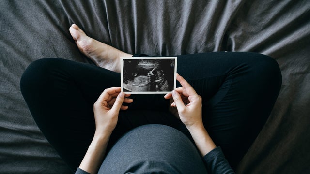 High angle shot of Asian pregnant woman holding an ultrasound scan photo in front of her baby bump, sitting on bed at home. Mother-to-be. Precious moment in life. Preparation for a new family member. Expecting a new life. Baby and new life concept 