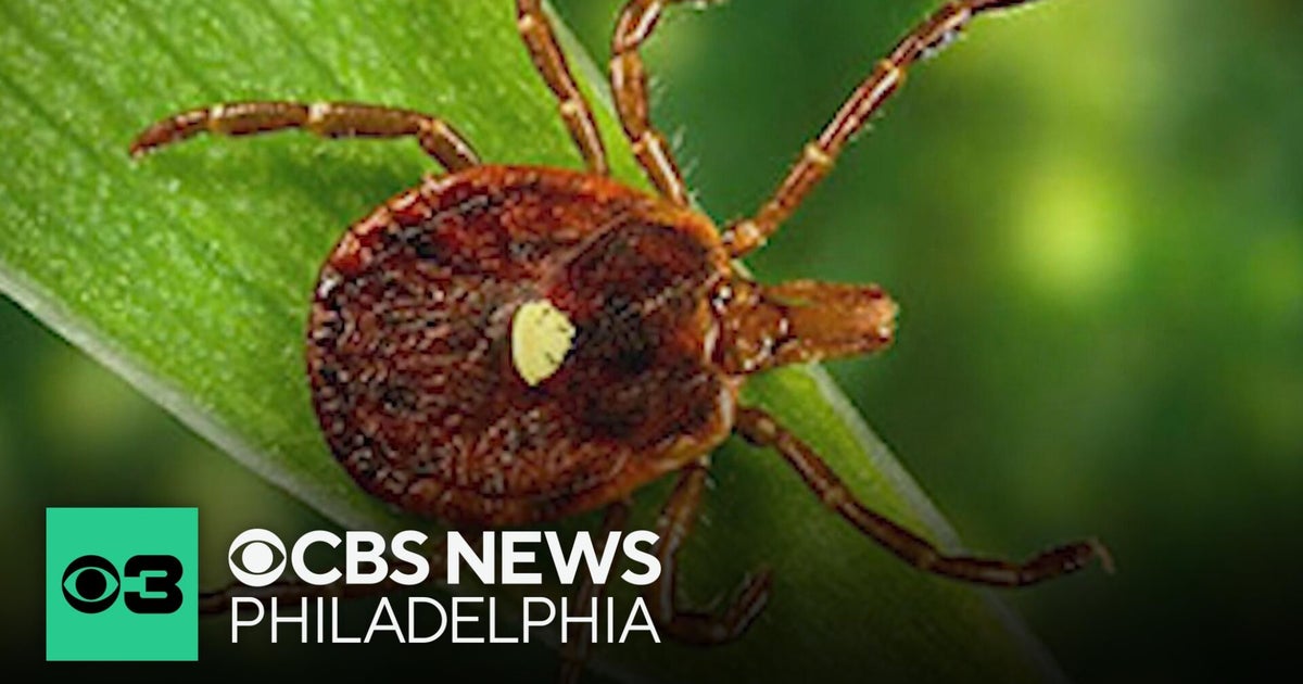 1st death linked to meat allergy spread by ticks, reported in New Jersey, researchers say