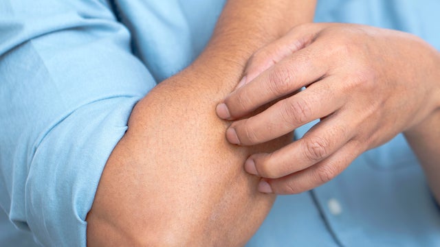 Man scratching his arm 