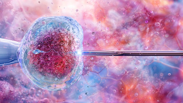 An illustration shows the process of artificial insemination or in vitro fertilization, known as IVF. 