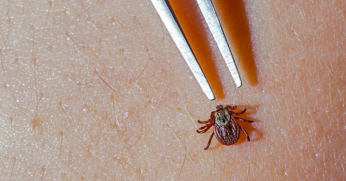 Lyme disease research at Johns Hopkins in jeopardy due to funding delays