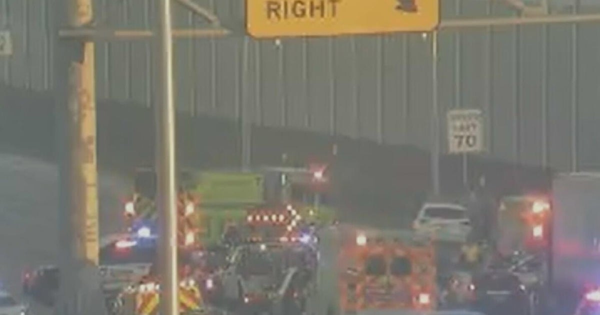 Miami-Dade Sheriff’s Office says deputy’s health improving after getting hit by vehicle