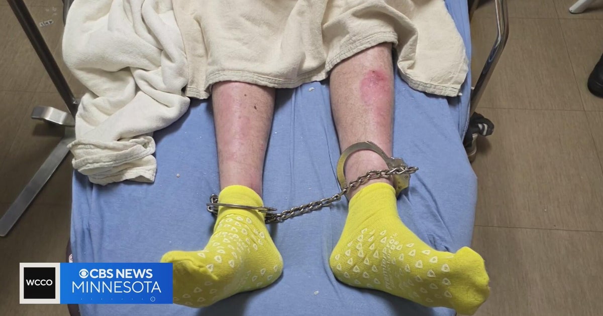 Libyan man who traveled to Minnesota for treatment of rare condition detained by ICE