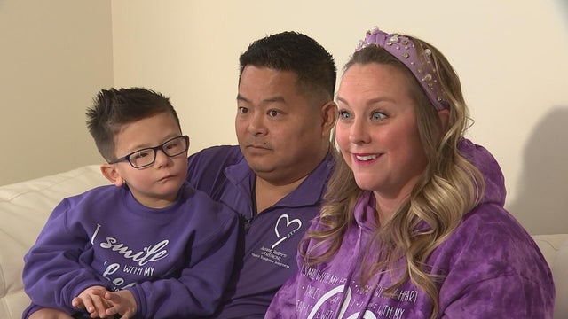 Bucks County family speaks out about condition that prevents son from smiling 