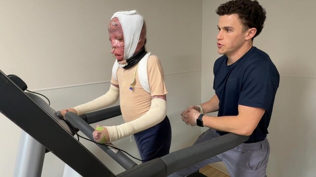 Ramesses practicing walking during physical therapy 