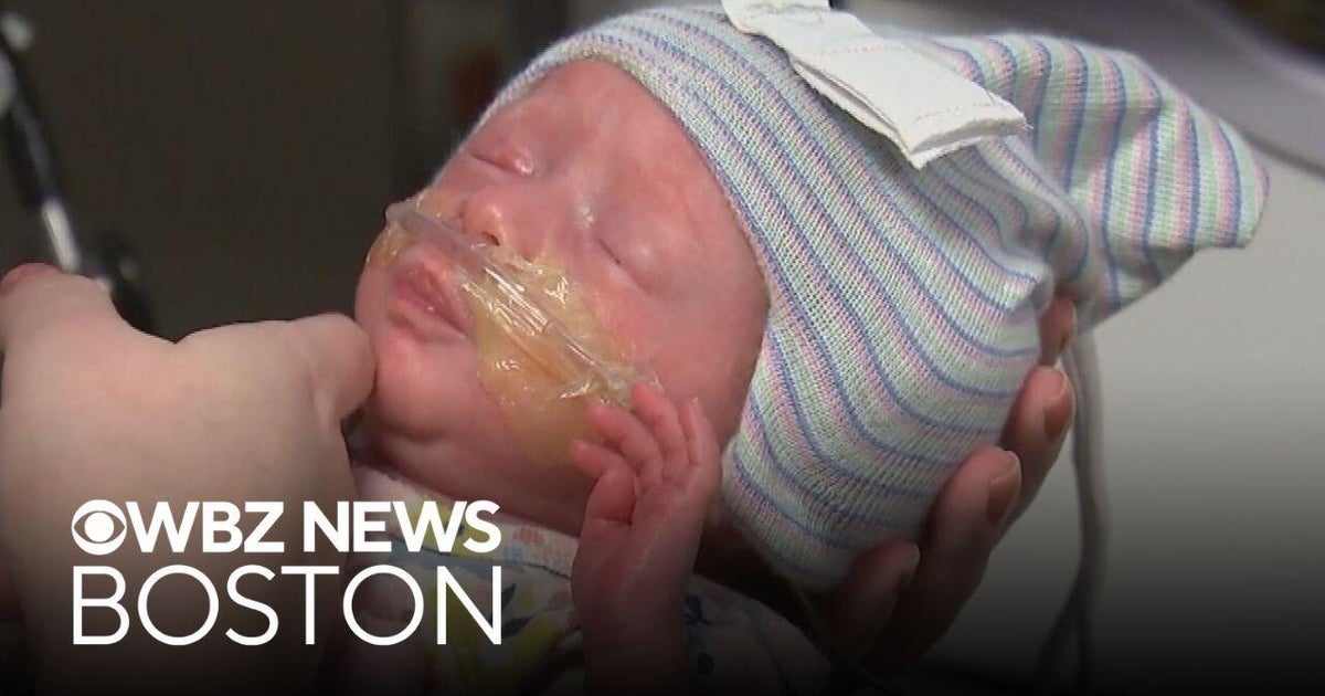 Hospital testing high-tech cap in NICU to reduce noises for babies