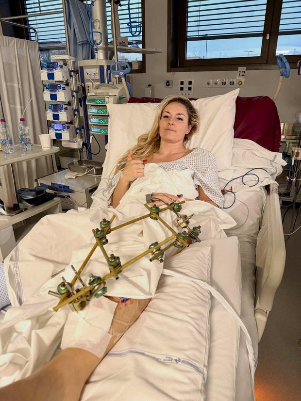 U.S. skier Lindsey Vonn lies in a hospital bed, after she crashed during the Women's Downhill, in Treviso 