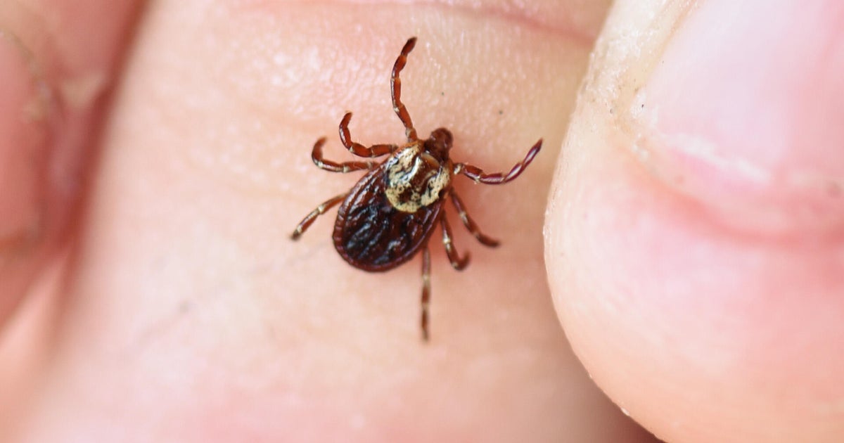 Pfizer working to get approval on new Lyme disease vaccine. Expert says tick activity rising in New England.