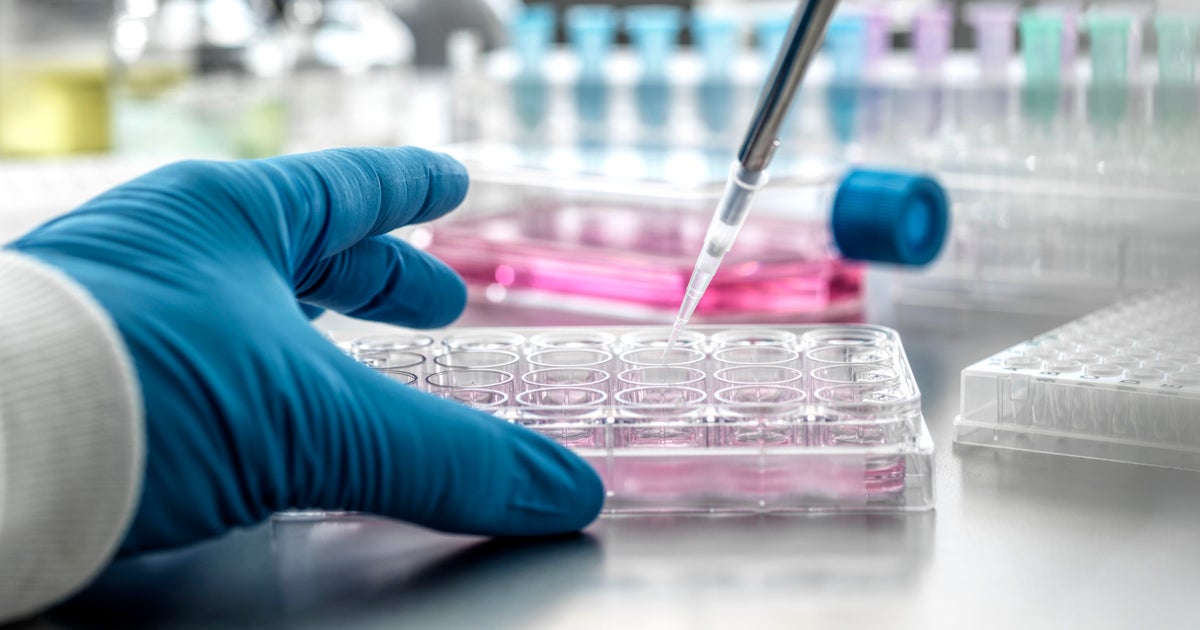 Stem cell therapy offers new hope for Parkinson’s patients as UM scientists aim to restore lost brain cells