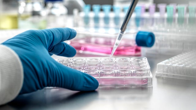 Scientist pipetting medical samples into microplate in laboratory 