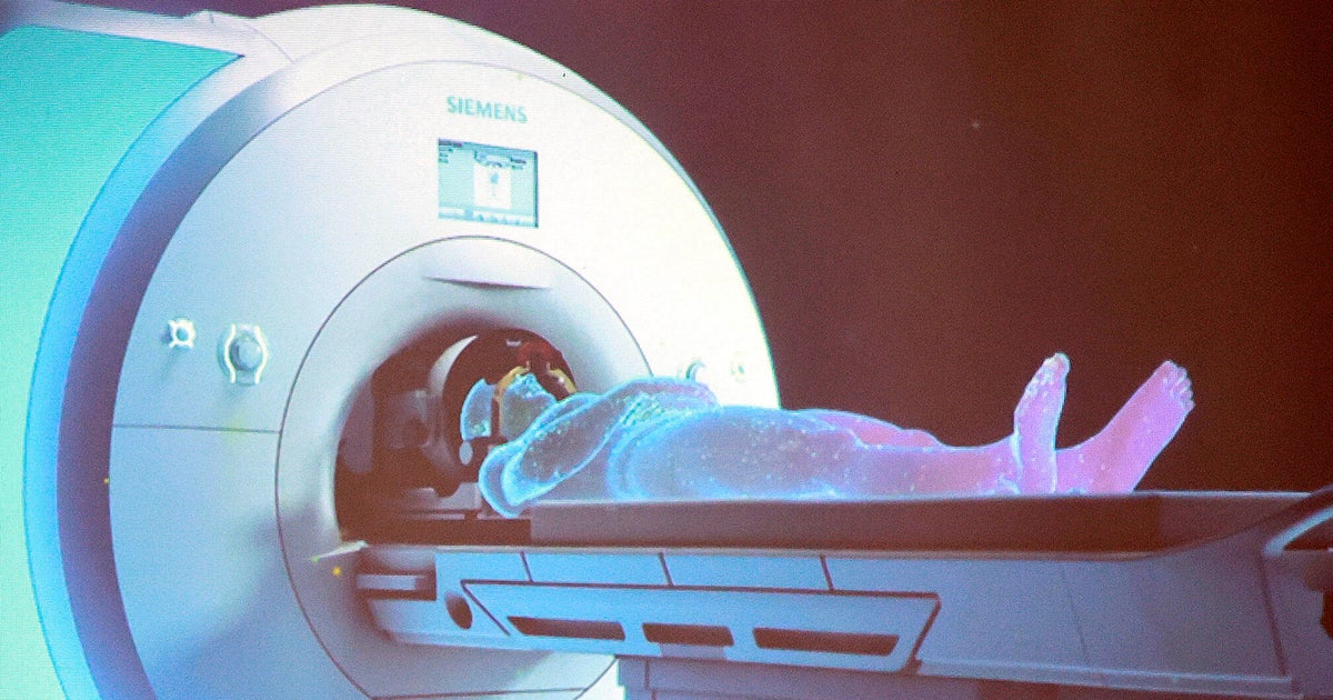 South Florida man says Parkinson's tremor vanished after incisionless ...