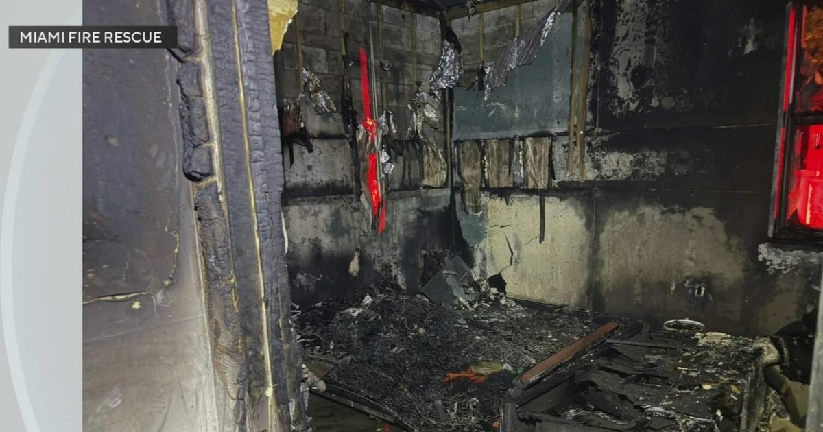 Miami apartment fire leaves man in critical condition after suffering ...