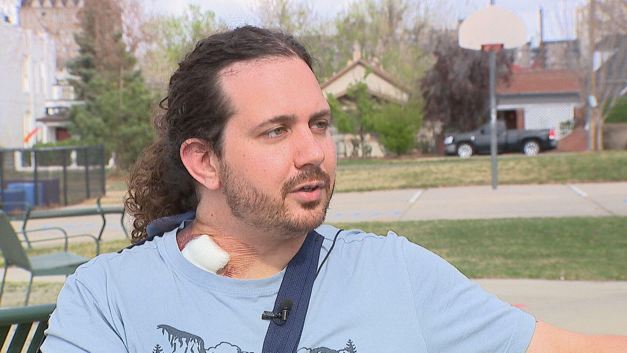 Man survives being shot in the neck in Denver; suspect facing attempted ...