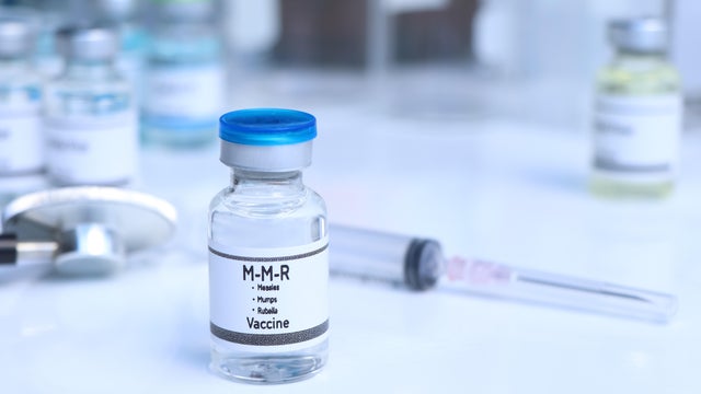 Measles, Mumps, Rubella vaccine in a vial, immunization and treatment of infection 