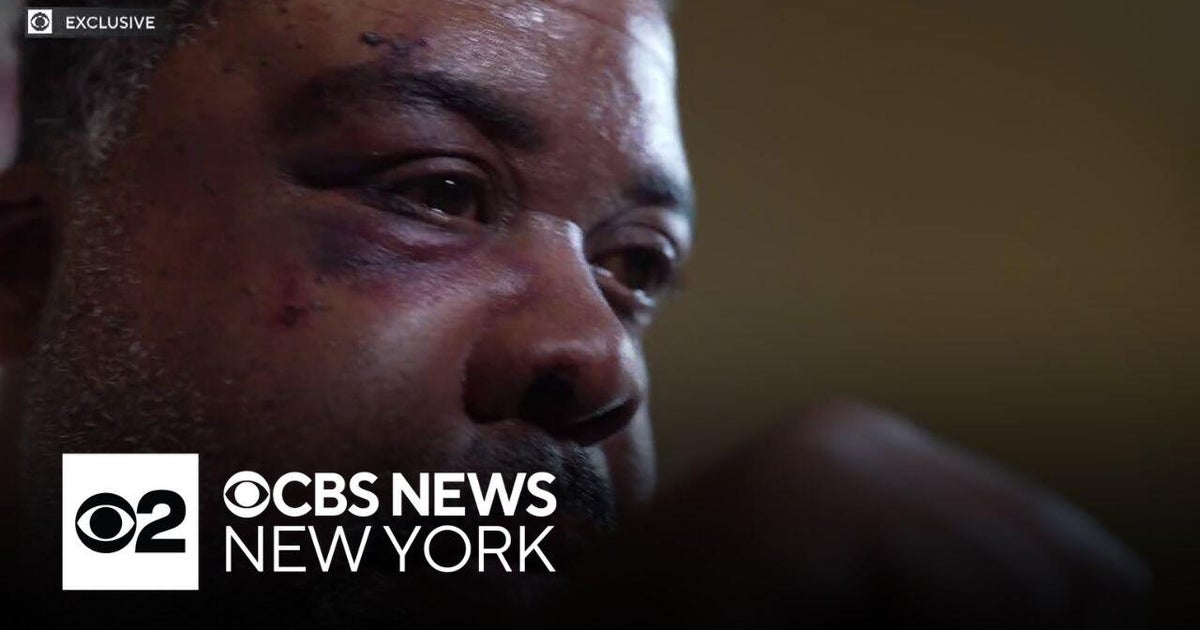 Brooklyn man injured in wrongful and violent arrest now planning to sue ...