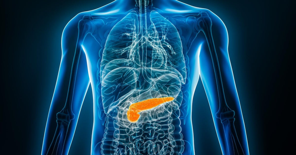 FDA expanding access to pancreatic cancer drug to some patients