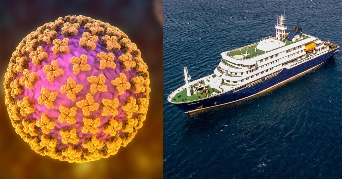 2 passengers on hantavirus-stricken cruise ship have rare strain, health officials say