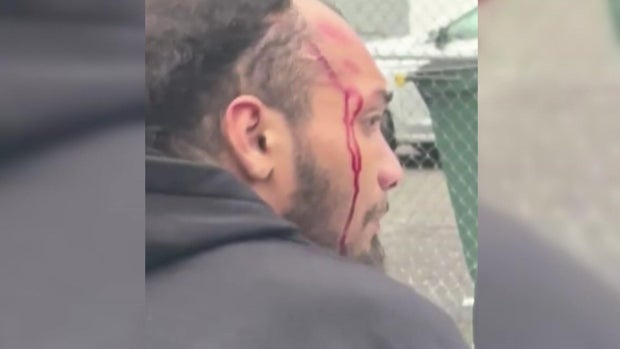 Jeury Concepcion with blood on his face 