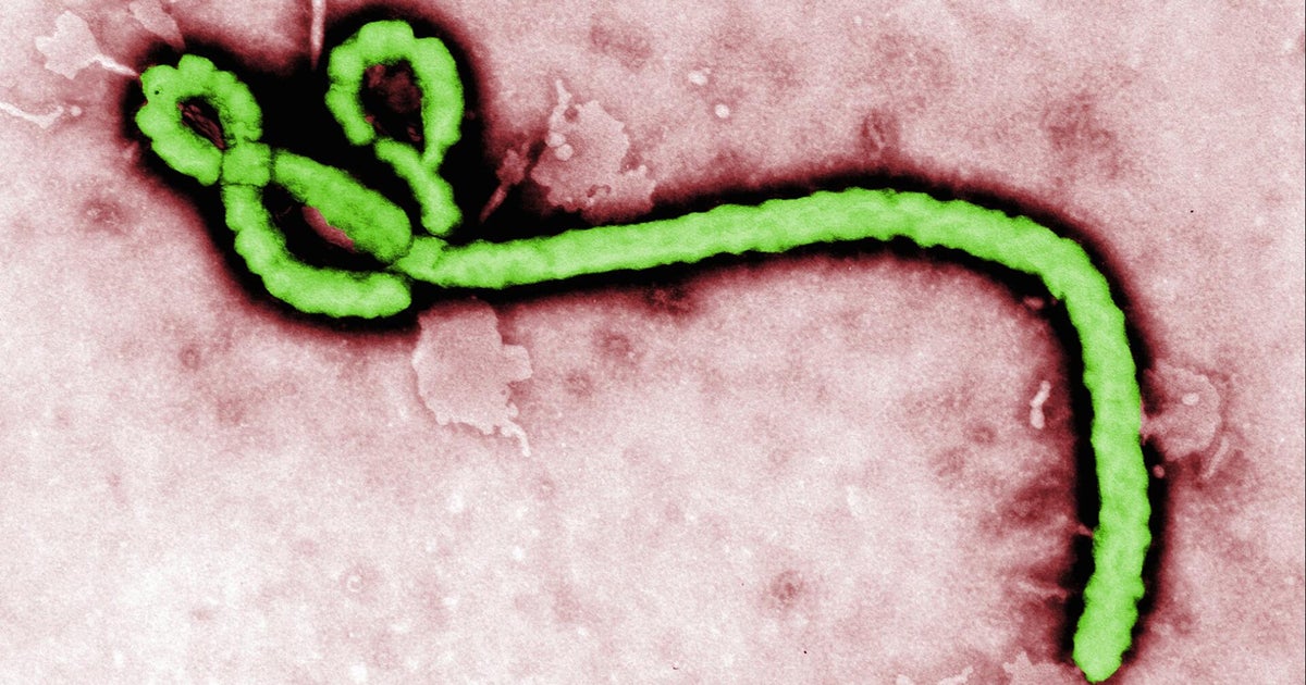 American doctor working in Congo tests positive for Ebola