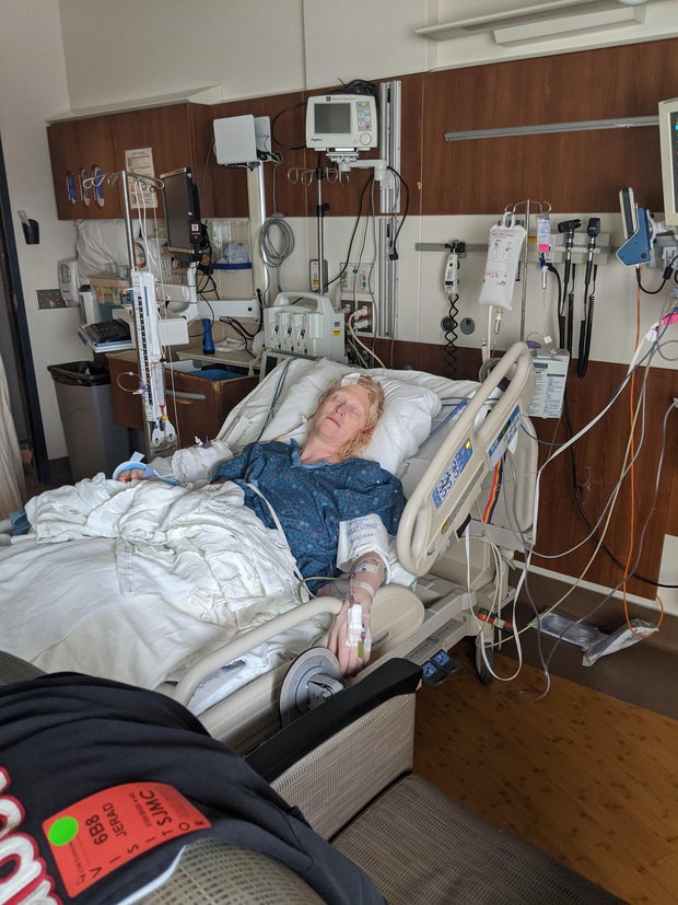 after-1st-surgery-feb-2020.jpg 