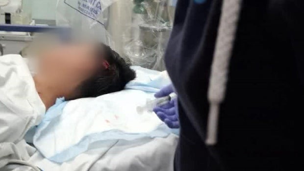 A teen lays on a table with a gash on his head 