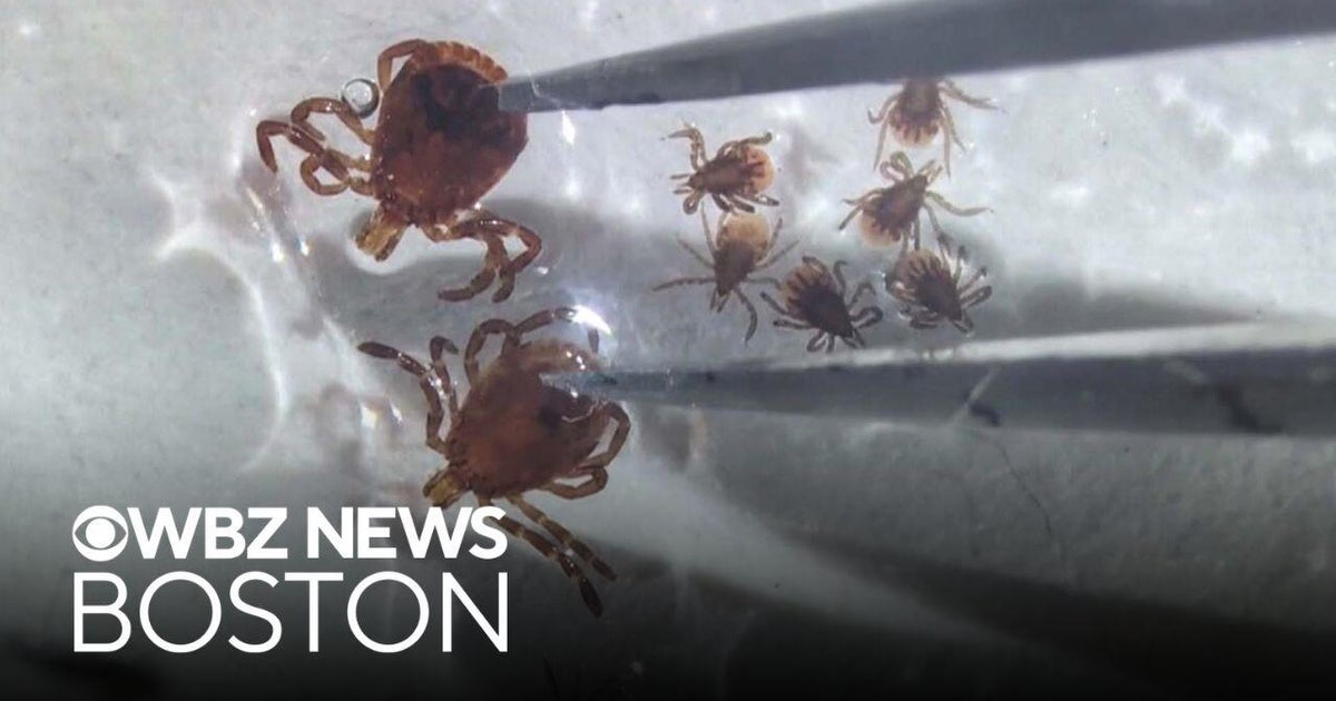 New Hampshire man battling deadly Powassan virus in Boston hospital