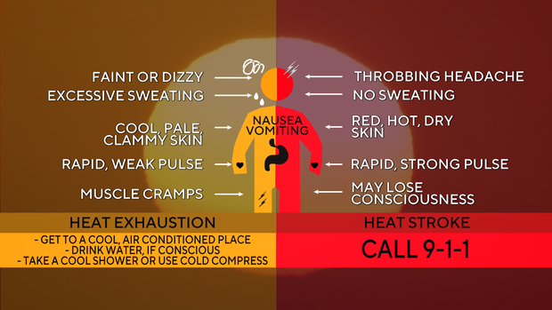 heat-exhaustion-vs-heat-stroke.png 
