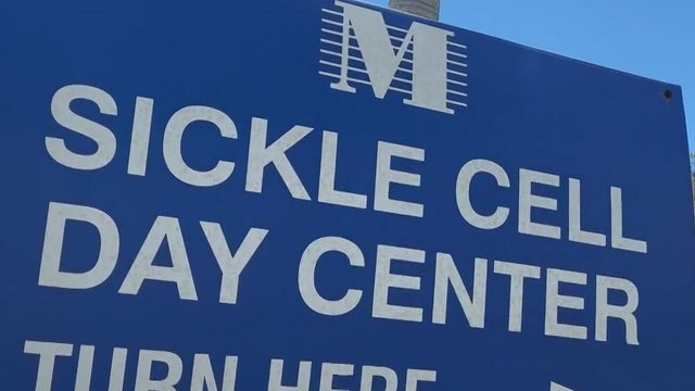 Sickle cell 