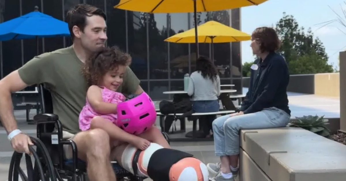 Los Angeles father has part of leg amputated after saving 2-year-old daughter from Venice crash