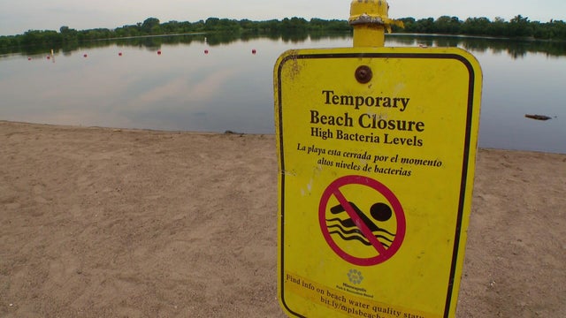 12p-vo-ecoli-beaches-closed-charest-040226.jpg 