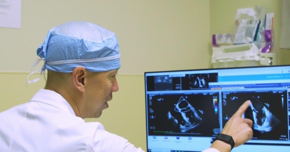 South Florida man lived decades with rare congenital heart defect
