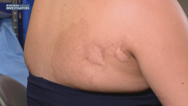fireworks-injuries.jpg 