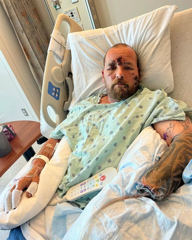 jason-in-hospital-del-nortte-explosion.jpg