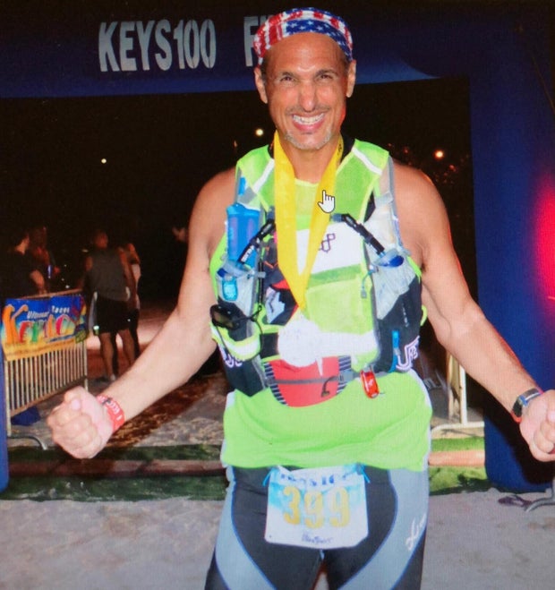 Man has "miracle" recovery after heart defect causes rare massive stroke