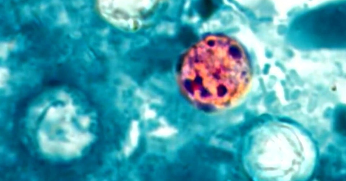 Lettuce linked to cyclosporiasis outbreak