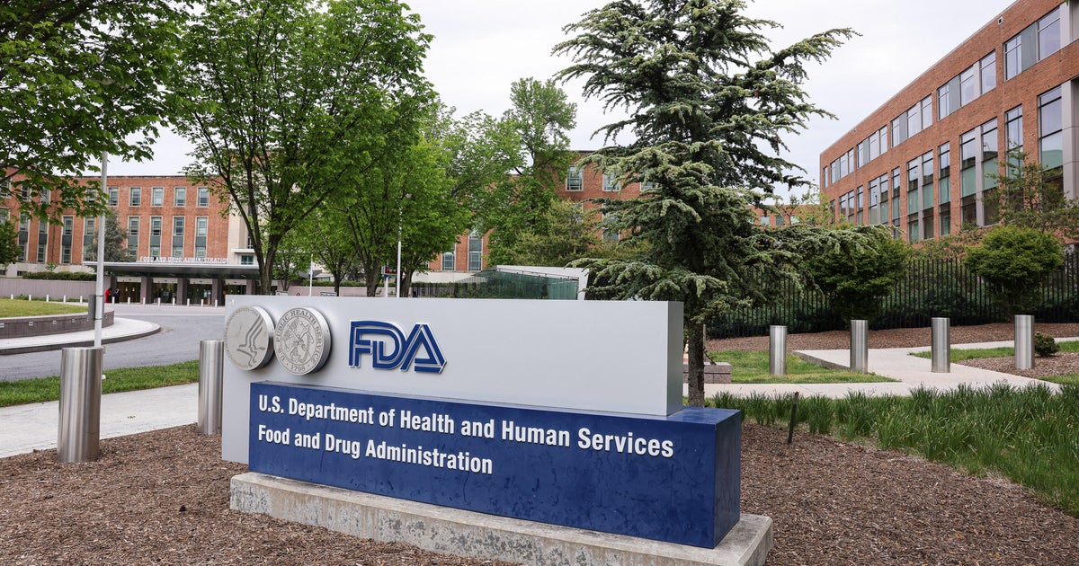 FDA казва, че е идентифицирала нова епидемия от циклоспора, свързана с неуточнен продукт