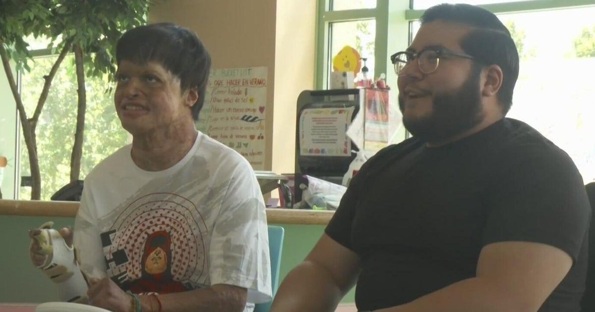 Friends who met as patients at Shriners Children Hospital reunite