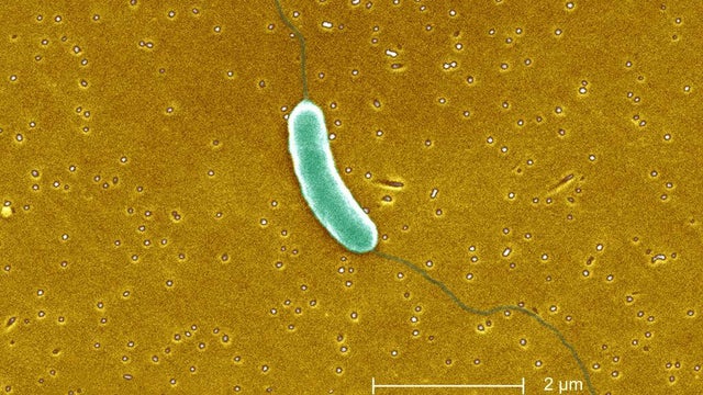 Vibrio vulnificus 