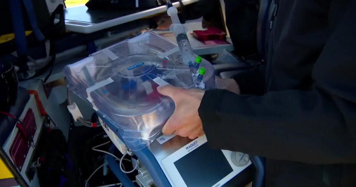 cbsnews.com - Ubah  Ali - Woman's life saved by ECMO machine thanks to new program designed to help rural Minnesotans