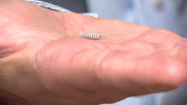 WiSE leadless pacemaker 