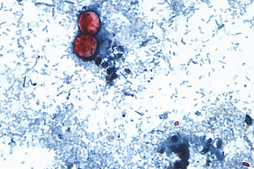 Cyclospora outbreak tied to 3 more states, FDA says
