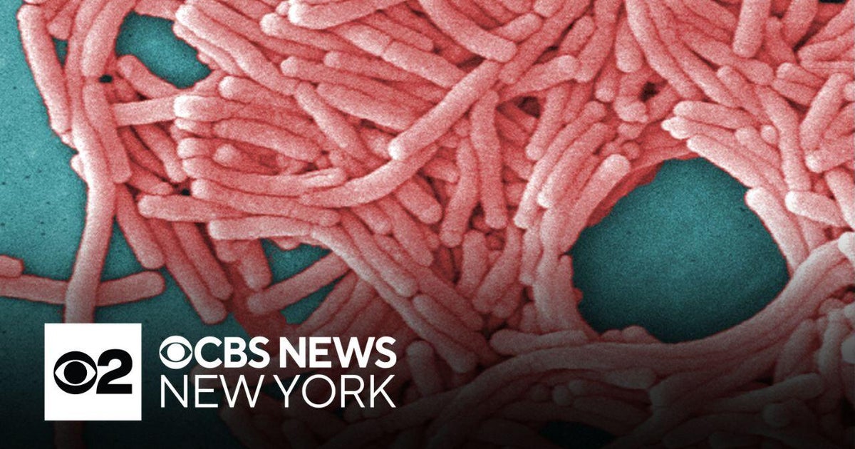 1 dead in new Legionnaires' disease cluster in the Bronx, health officials say