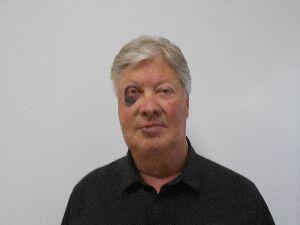 robert-morris-black-eye.jpg 