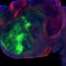 Neuroscientist explains how his team grew human brain tissue in mice and breaks down what they found
