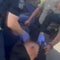 Man shot by ICE in custody with bullet lodged near his spine, lawyer says