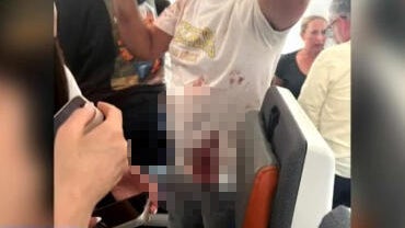 New images show injured pilots after midair cockpit fight