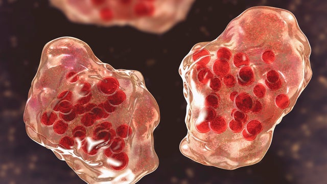 Illustration of measles cells 