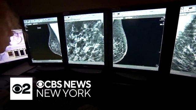 People can assess their breast cancer risk with the help of AI